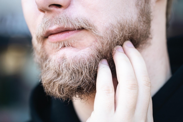 Bald Patches on Beard What It Means & Solutions 