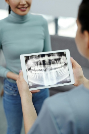 How Full Mouth Rehabilitation and Dental Implants Can Completely Transform Your Smile
