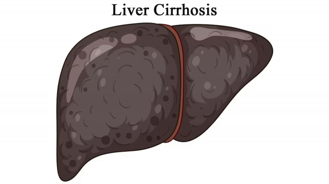 Liver Cirrhosis Market Size, Trends, and Growth Forecast Analysis 2025-2032