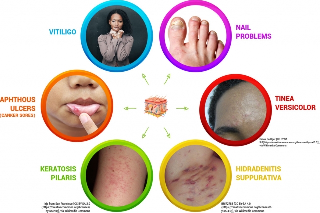 Holistic Dermatology A Whole Body Approach to Healthy Skin
