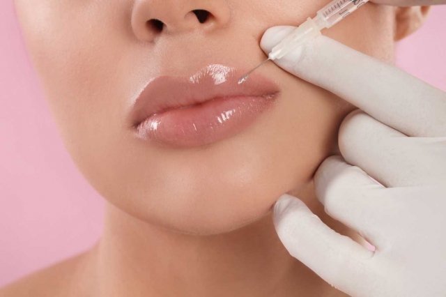 How Long Do Lip Fillers Last long