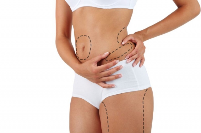 From Flab to Fab: Liposuction Weight Loss Surgery Success Stories