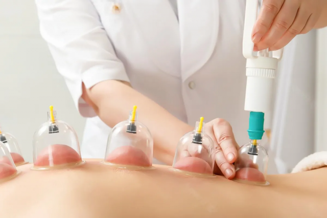 How Hijama Therapy improves skin?