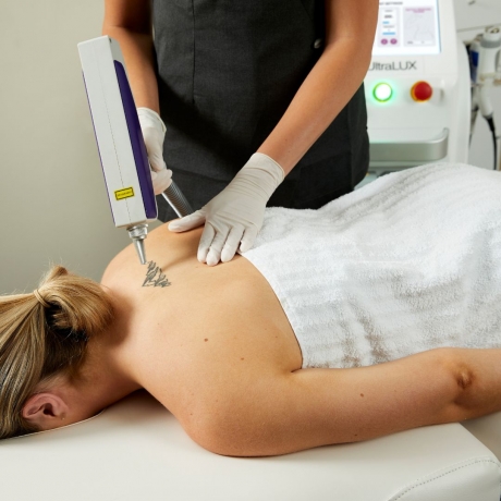Clear Skin, Clear Mind – Laser Tattoo Removal Works!