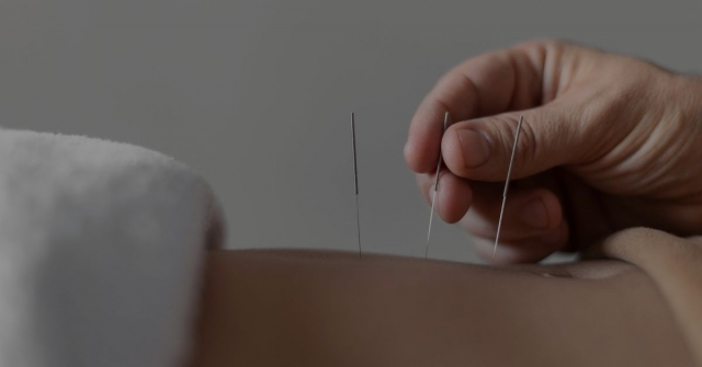 Discover the Power of Acupuncture Treatment for Woodbury MN: A Natural Path to Wellness