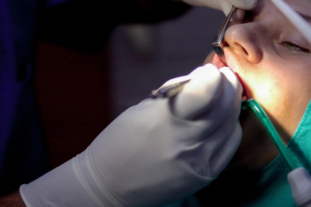 Budgeting for Your Dental Care: Root Canal Edition