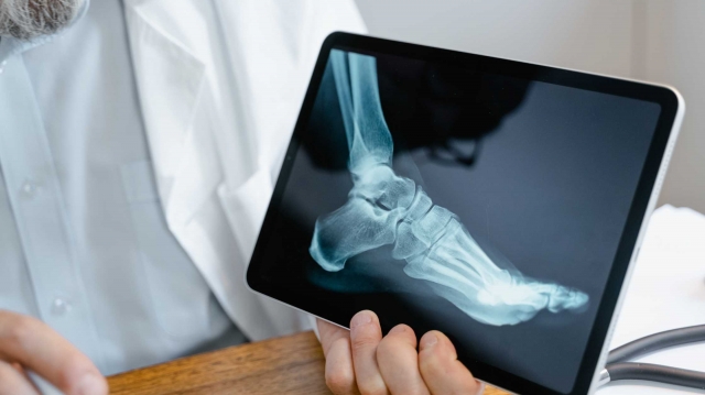 A New Life Without Knee Pain: Meet the Best Knee Replacement Surgeon in Ahmedabad