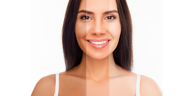 Top Technologies Used for Skin Whitening in Islamabad Clinics