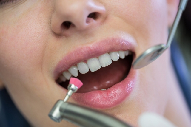 Teeth Cleaning vs Whitening: What’s the Difference?