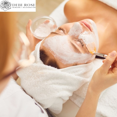 Skin Peels for Different Skin Types: What Works Best?