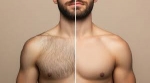 Cellulite Laser Treatment: Smoother Skin Starts Here