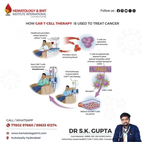CAR T Cell Therapy in Hyderabad: Expert Care by Dr. S.K. Gupta
