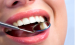 Why Choose Newsmilesortho for your Chili NY Orthodontic Treatment?