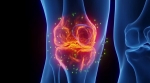 Knee Osteoarthritis Market Size, Trends, and Growth Outlook 2025-2032