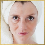 Are You Ready for a Facelift? Everything You Need to Know About This Popular Cosmetic Procedure