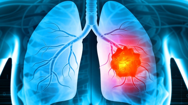 Cancer Pain Market Size, Trends, Growth Forecast