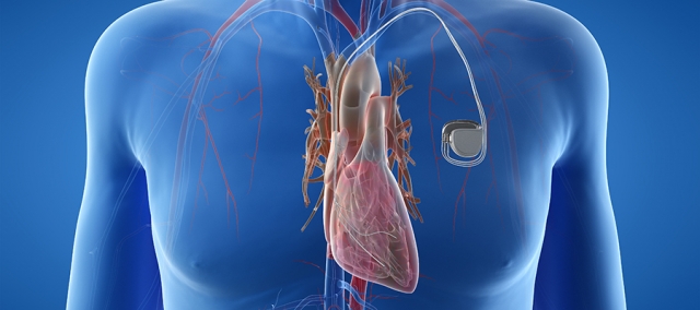 Cardiac Restoration Systems Market Size, Trends & Growth Analysis 2025-2032
