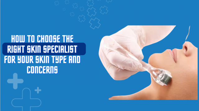 How to Choose the Right Skin Specialist for Your Skin Type and Concerns