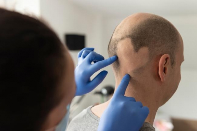 Alopecia Areata Treatment Market Size, Trends, and Growth Insights 2025-2032