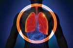 Interstitial Lung Disease Treatment Market Forecast, Growth | Size and Share by 2025-2033