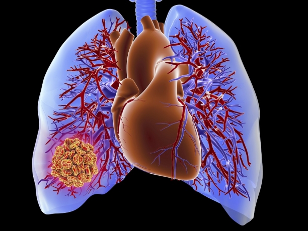 Chronic Thromboembolic Pulmonary Hypertension (CTEPH) Market Size, Trends, and Growth Analysis