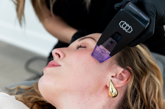 Morpheus8 Treatment Is the Star of Every Skincare Trend