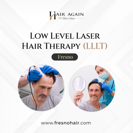 Laser Hair Therapy Fresno: A Breakthrough in Non-Invasive Hair Restoration