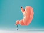 Lose Weight Fast Riyadh: Gastric Balloon Solution