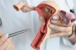 Traitement du Cancer de la Vulve en Inde avec EdhaCare : Soins de Pointe à Coût Abordable