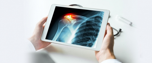 Digital Mobile X Ray Devices Market: Size, Trends, and Strategic Outlook 2025-2032