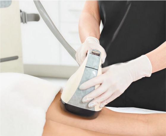 Discover the Power of VelaShape Treatment Dubai: The Ultimate Non-Invasive Body Contouring Solution