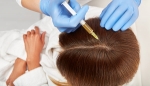 write How prp injection in dubai Boosts Hair Growth in Dubai 