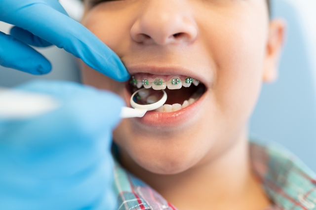 Do Orthodontic Services Cover Invisalign and Braces?