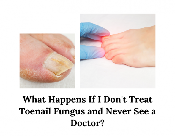 What Happens If I Don't Treat Toenail Fungus and Never See a Doctor?