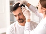 Hair Transplant for Receding Hairlines – Islamabad’s Expert Advice