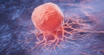 Emerging Advances and Market Dynamics in Cancer Biomarkers Market