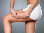 How Non-Surgical Thigh Lifts Improve Skin Tightness and Texture