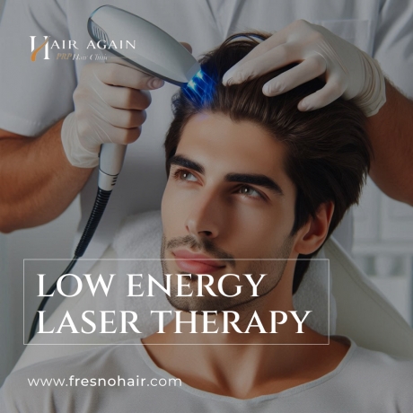 A complete guide of Laser Hair Therapy Fresno