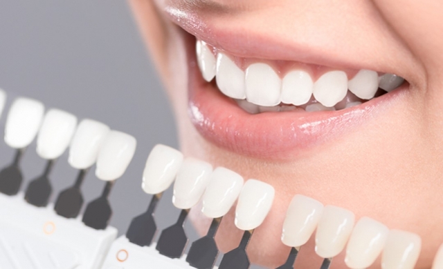 The Truth About Dental Veneers: Myths, Facts, and How to Get the Best Results