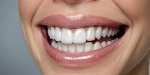 Do Veneers Hurt During or After the Procedure?