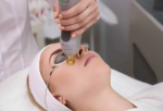 Laser Hair Treatment – What to Expect After the First Session