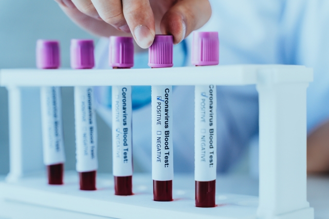 Convenience at Your Fingertips: Ordering Your Blood Tests Online