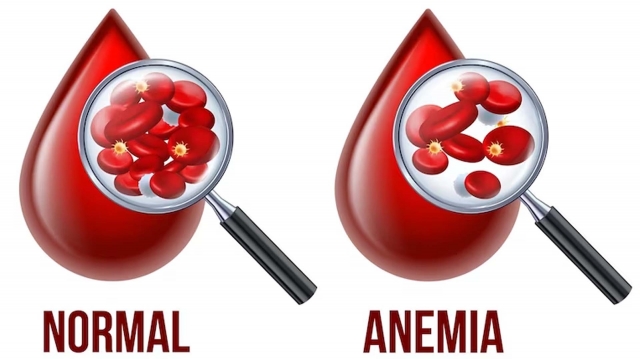 Aplastic Anemia Market Outlook, Dynamics, and Expansion Projection 2025–2032