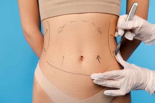 Bold and Beautiful with Liposuction Dubai Curves