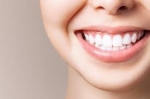 Is Laser Teeth Whitening Worth It?