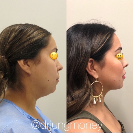 Top Cosmetic Surgery Trends In Houston For 2025