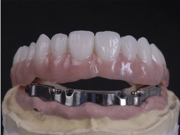 Why Dentists and Dental Labs Worldwide Choose a China Dental Lab for Outsourcing?