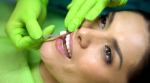 Transform Your Smile with Porcelain Veners