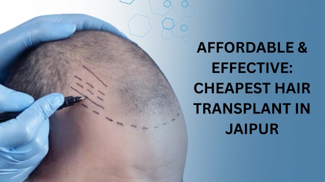 Affordable & Effective: Cheapest Hair Transplant in Jaipur