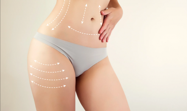 Confidence Starts Here Best Liposuction Doctors in Dubai Share Insights